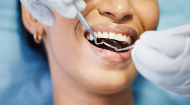 Best Emergency Dental Care for Broken or Chipped Teeth in Lockney, TX